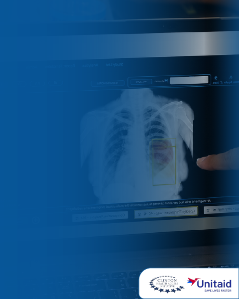AI solutions for transforming Radiology Workflow 